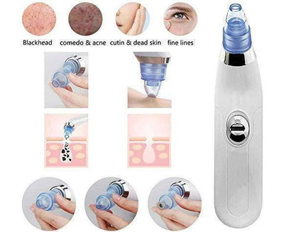 Acne Pimple Pore Cleaner Vacuum Suction Tool - ROYAL SUPER